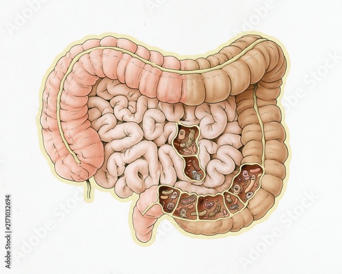 What bacteria exist in the intestines