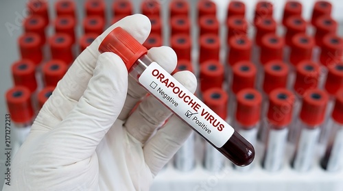 Medical professional holding blood test vial labeled Oropouche virus with positive result