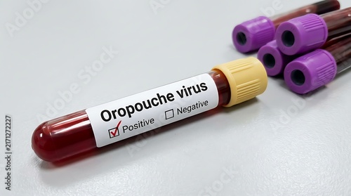 Medical test tube with positive Oropouche virus blood sample in laboratory setting