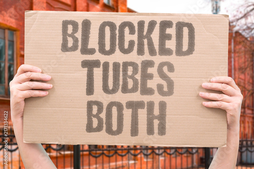Fotografie "Blocked tubes both" HSG confirmed bilateral tubal occlusion