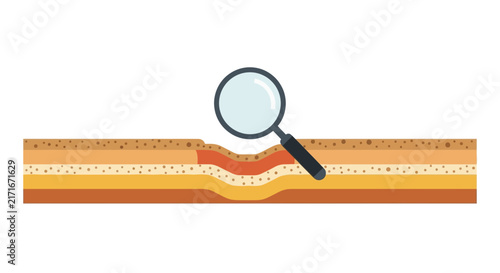 Skin Layer Cross-Section with Magnifying Glass Illustration