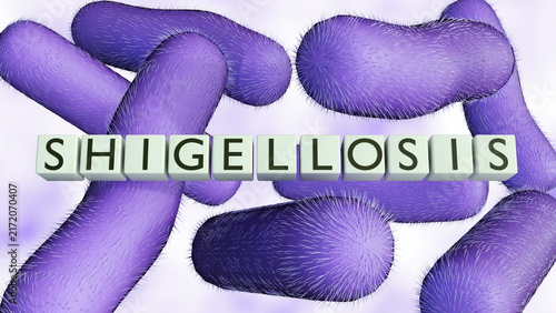 Bild auf Leinwand A 3d SHIGELLOSIS blocks over rod-shaped purple bacilli of shigella