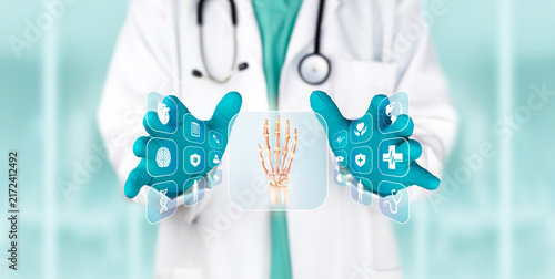 Cuadro en lienzo Doctor examining a digital chart on a screen to detect abnormalities in the bones of the hand and diagnose fractures, osteoarthritis, and osteoporosis