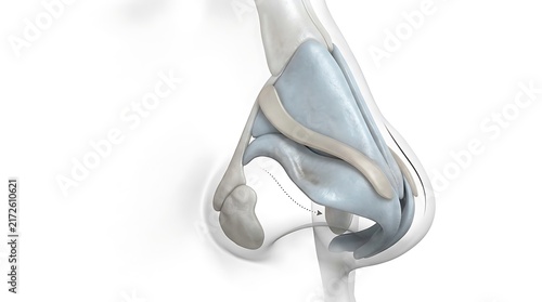 3D medical illustration of nasal cartilage reconstruction showing the precise placement of a surgical graft for alar batten reconstruction in the human nose on a clean white background.