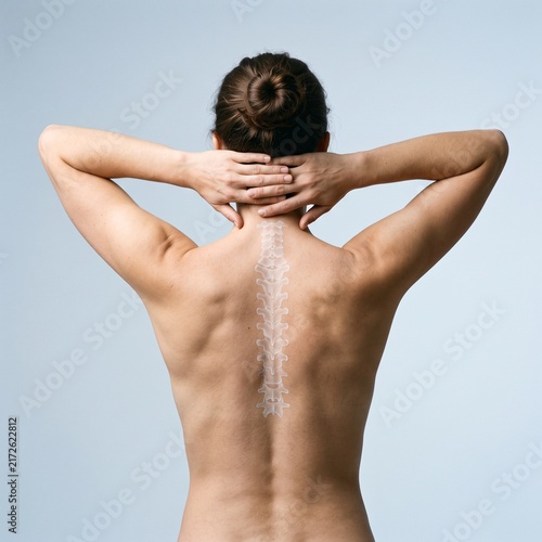 Woman Showing Spine Anatomy and Neck Posture from Behind