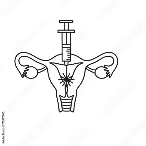 Uterus and Ovary Illustration with Syringe