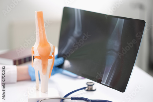 Cuadro en lienzo doctor wearing blue gloves closely examines knee joint model in medical office setting, using stethoscope and x-ray image on desk, professional and clinical environment, white, orange, blue