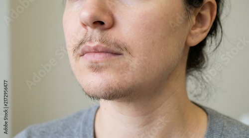 Close-up of a person's face showing facial hair growth on the upper lip and chin area.