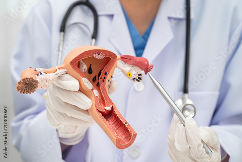 Bild auf Leinwand Uterus, doctor holding human anatomy model for study diagnosis and treatment in hospital