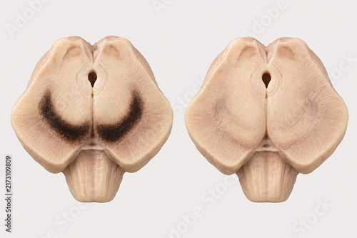 Midbrain comparison of healthy and depleted substantia nigra