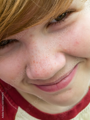 Extreme Close Up Portrait of Smiling Freckled Nose and Eyes