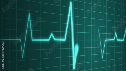 Irregular heartbeat line flat start and end, showing a medical ecg pattern and heart rhythm problem animation