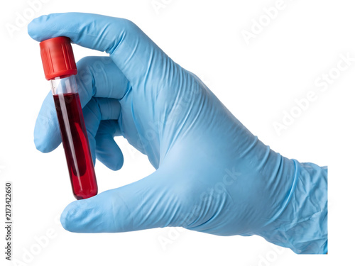 Gloved Hand Holding Blood Sample Test Tube Isolated on PNG Background blood, test, tube, sample, glove, hand, laboratory, medical, health, clinic, analysis, doctor, science, vial, liquid, red, diagnos
