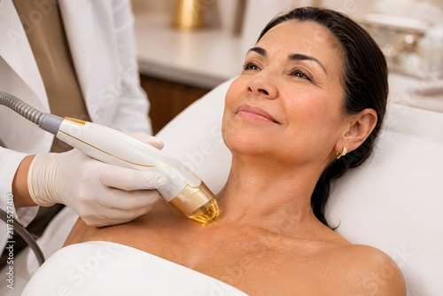 Microneedle RF lifting treatment on neck and decollete of mature woman