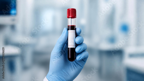 mão com coleta de sangue para exames laboratoriais 