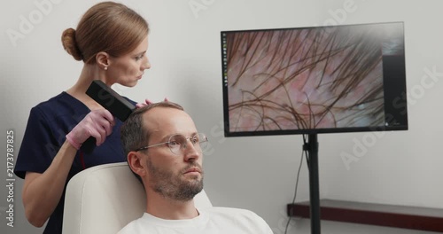 Closeup male scalp treatment with handheld laser device at hair clinic for thinning hair examination and medical consultation.