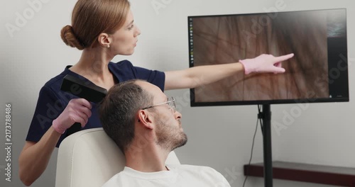 Male scalp consultation at hair clinic with trichoscopy monitor, concept men with alopecia.