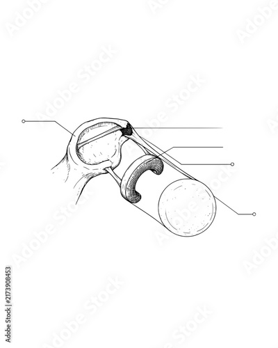Technical line drawing of a human joint structure with labels for orthopedic anatomical study