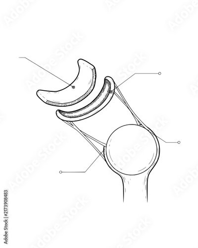 Anatomical Diagram of Knee Joint with Meniscus and Ligaments