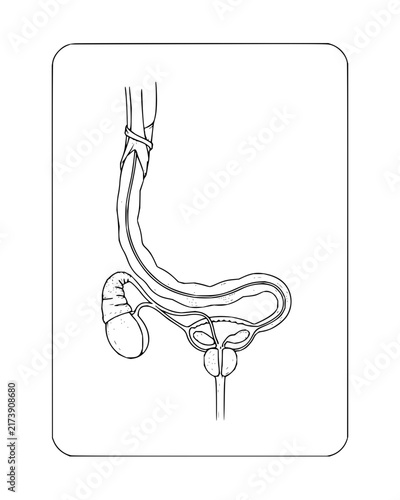 Anatomical Diagram of Male Reproductive and Urinary Systems