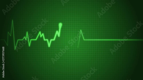 Healthcare Diagnostic Animation with Cardiac Pulse Wave, Emergency Heart Monitor Signal Animation with ECG Visualization