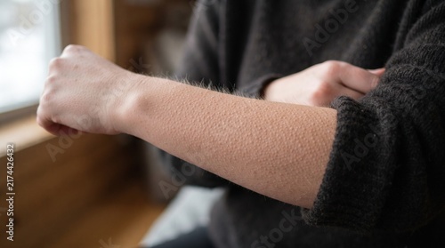 Close-up of Goosebumps on Arm in Cozy Indoor Setting