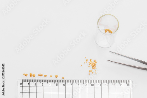  Kidney stones measured with ruler and laboratory tweezers on white background.