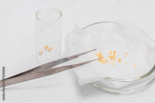 Kidney stones examined with laboratory tweezers in a petri dish.
