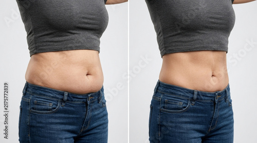 Before and After Weight Loss, Woman's Abs Comparison