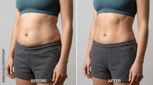 Body Transformation: Before and After Weight Loss Comparison