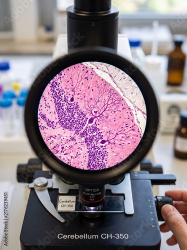 Obraz na płótnie Digital Optical Microscope Displaying Histological Cerebellum Tissue Slide