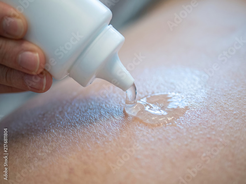 Foto Applying Conductive Ultrasound Scan Gel from Squeeze Bottle onto Skin