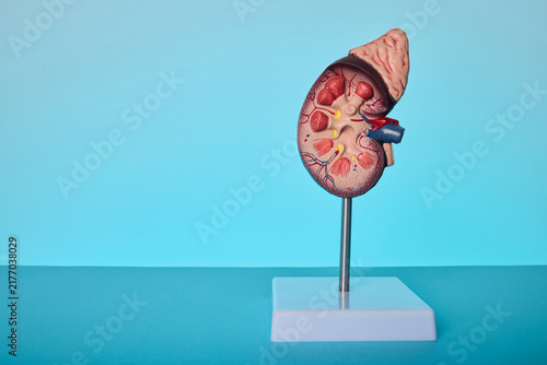 Anatomical kidney model on blue background. Medical treatment of nephritis and renal stones.