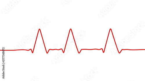 Red ECG line pattern transitioning from flat to sharp peaks on white background, medical graphic.