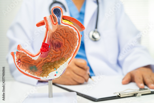 Fotografía Stomach disease, doctor holding anatomy model for study diagnosis and treatment in hospital