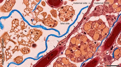 Microscopic view demonstrating environmental contaminant plastic fiber accumulation within delicate biological system, showing potential health risk, cellular damage, organism danger, adverse impact.