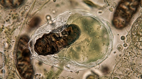 Autophagosome engulfing damaged mitochondrion, showing cellular autophagy, organelle recycling, biogerontology rejuvenation, nanoscale biological fluid dynamics.