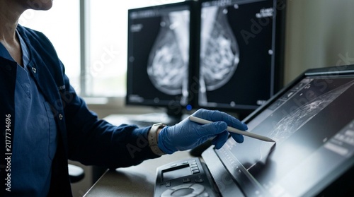 Mammography technologist reviewing a patient prior mammogram images before beginning a new screening