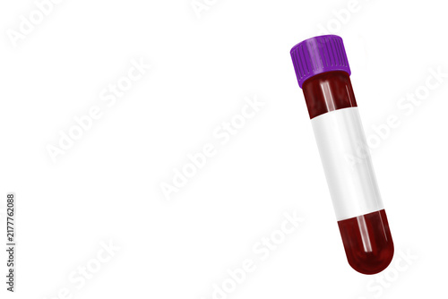 Photography Purple cap EDTA blood collection tube with blood sample isolated on transparent background