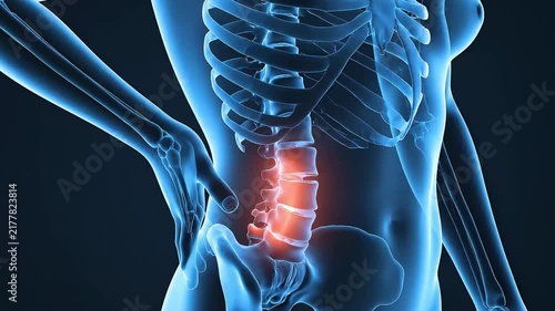 Hologram Human Pain Visualization