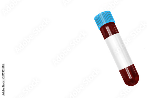 Canvas Print Light blue cap sodium citrate blood collection tube isolated on transparent background