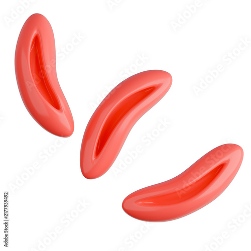 3D rendering of sickle red blood cells showing crescent drepanocytes for sickle cell anemia.