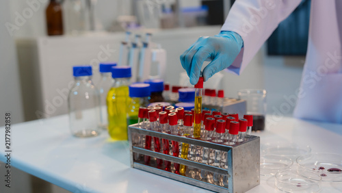 Cuadro en lienzo Scientist holding beaker with yellow chemical liquid in chemistry laboratory