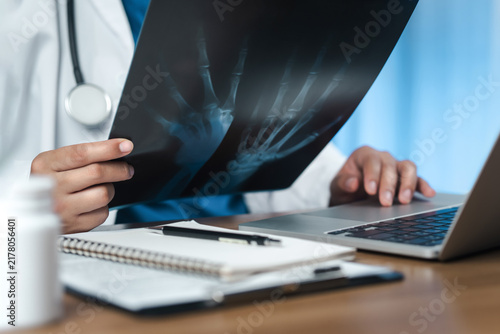Cuadro en lienzo Doctor examining x-ray film and taking notes on document while working on laptop computer in clinical office, medical diagnosis concept