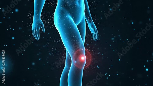 Knee Pain Anatomy Visualization