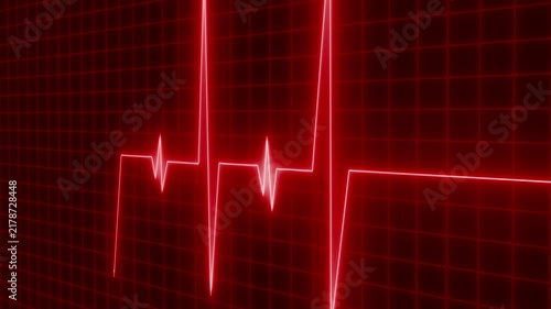 Glowing ecg heartbeat trace on grid background animation