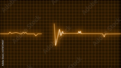 Glowing neon ecg heartbeat waveform on grid background animation