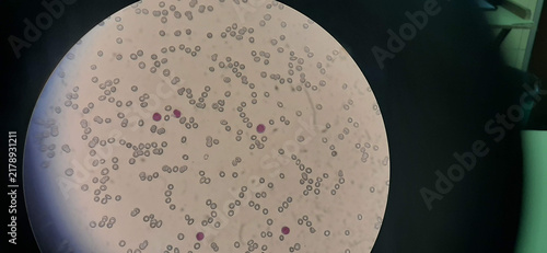 Foto Peripheral blood smear under microscope showing erythrocytes and leukocytes in c