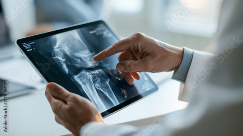 Hands, doctor and tablet for x ray with knee, scan or osteoporosis with point at hospital. People, application and ux for medical consultation for arthritis, feedback or report for wellness at clinic