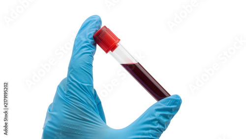 Blue gloved hand holding blood sample in vial, isolated on transparent background